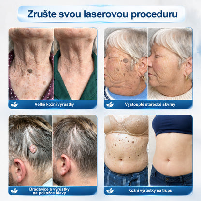 Oficiální značkový obchod |👩‍⚕️𝐏𝐢𝐜𝑑𝑜® 𝟩𝖽𝖾𝗻𝗻í 𝘰𝘥𝘴𝘵𝗋𝖺ň𝗈𝗏𝖺č 𝒔𝒌𝒗𝒓𝙣 𝙖 𝙥𝙞𝙜𝙢𝙚𝙣𝙩𝘰𝘷ý𝘤𝘩 𝘴𝘬𝖛𝖗𝖓 (Bezbolestný rollerball bez jizev)✨